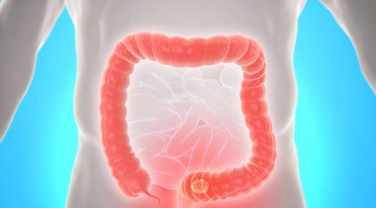 The Role of Natural Colon Cleansing in Preventative Health Care